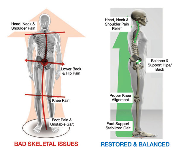 Skeletal Before and After